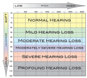 What Level of Hearing Loss Requires a Heading Aid?